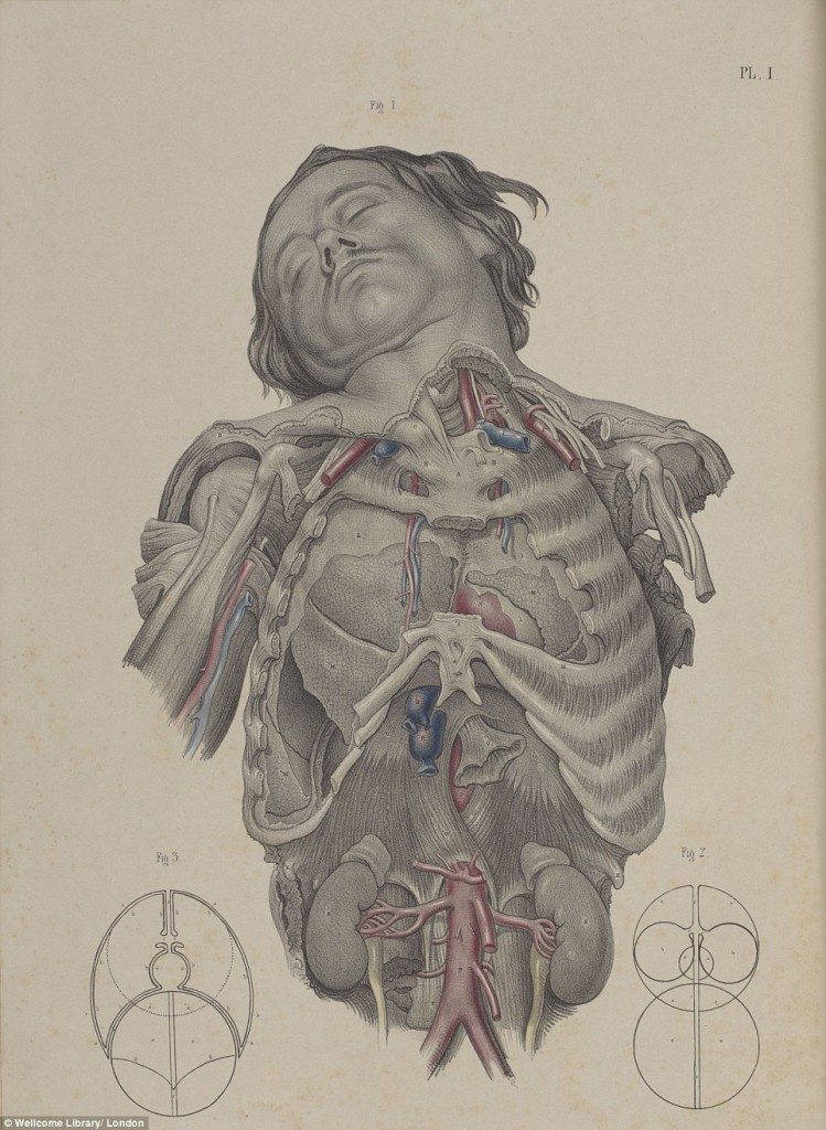 302FFCAB00000578-3400943-Medical_Diagram_from_a_1856_book_shows_how_doctors_would_dissect-a-3_1453108837200